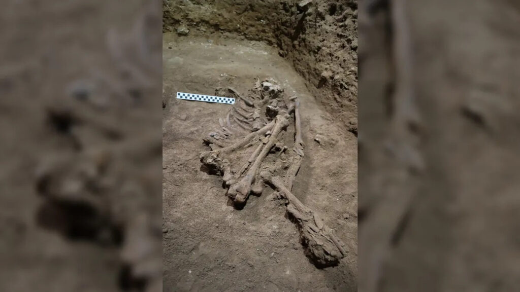 photograph of a child with oldest amputation in the world