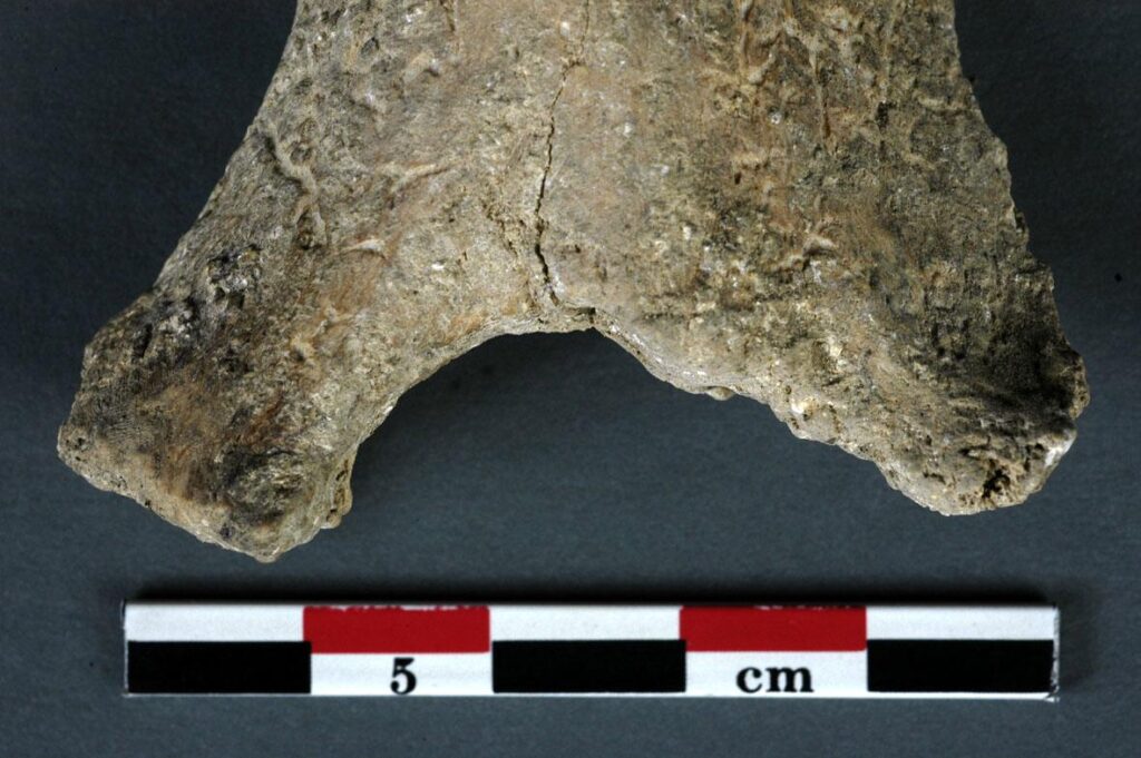 image of neolithic man in france with arm amputation