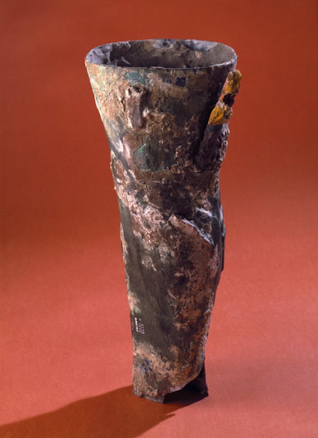early prosthetic leg for leg amputation
